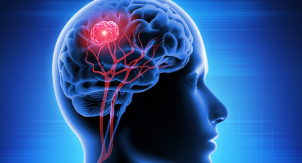Updates in Neurocritical Care and Trauma Literature